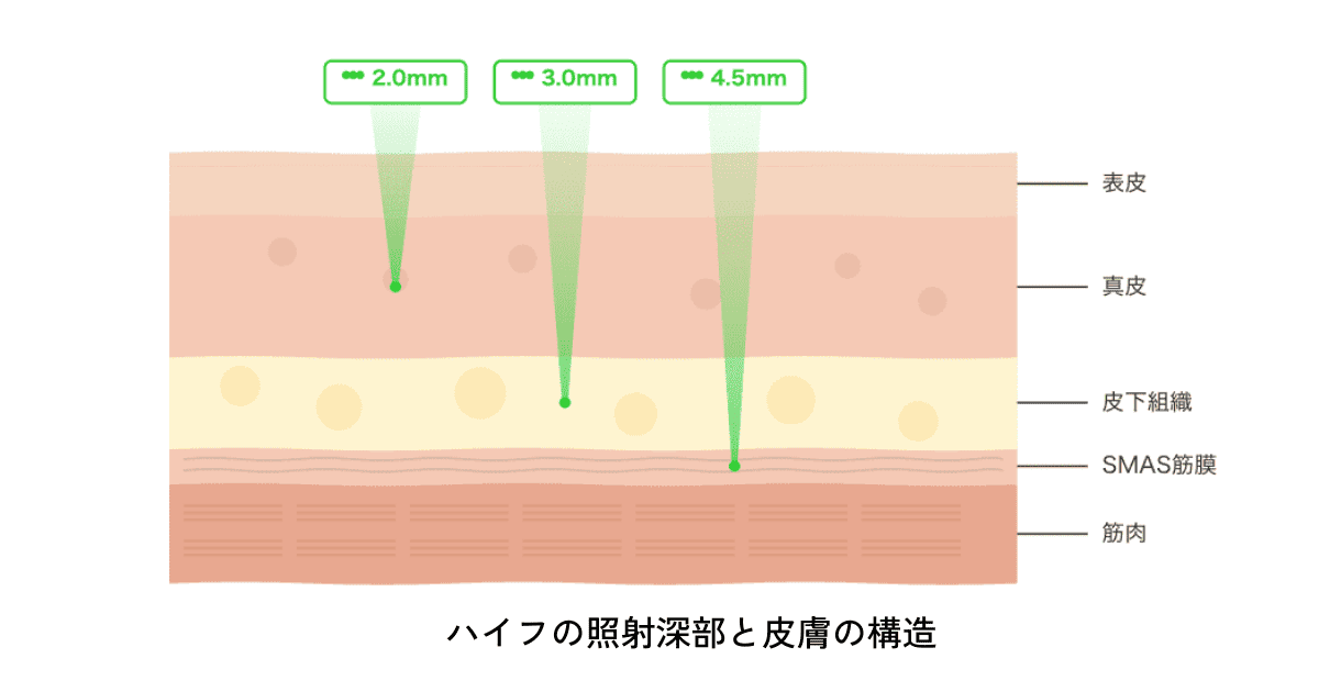 ハイフの照射深部と皮膚の構造